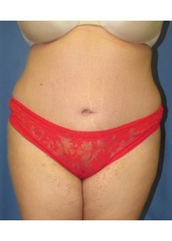 After Image