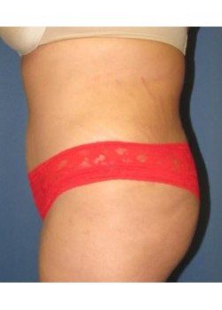 After Image