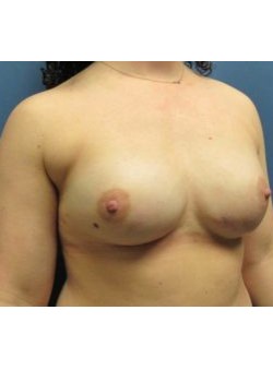 After Image