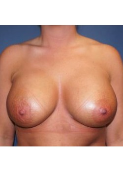 After Image