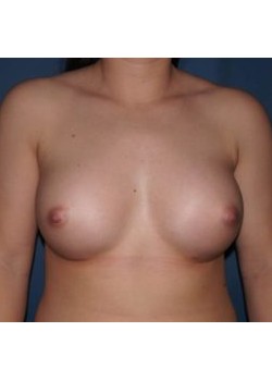 After Image