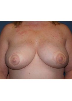 After Image