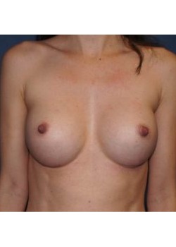 After Image
