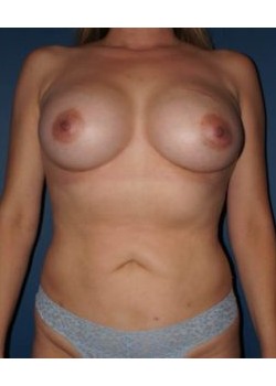 After Image
