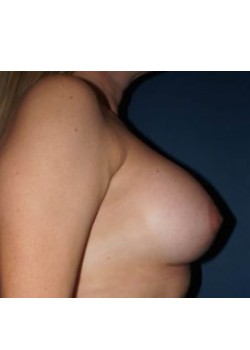 After Image
