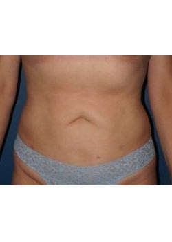 After Image