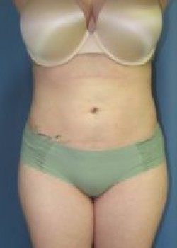 After Image