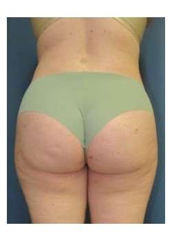 After Image