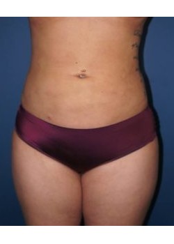 After Image