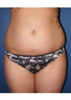 Before Image