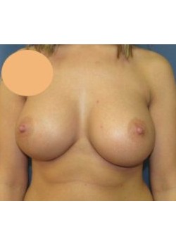 After Image