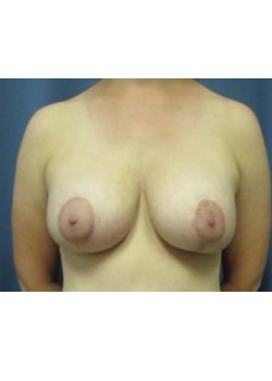 After Image