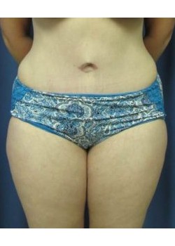 After Image