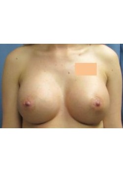 After Image
