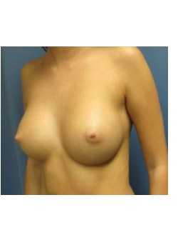 After Image