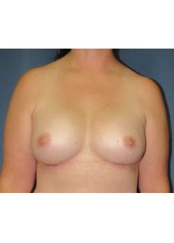 After Image