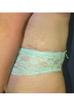 After Image