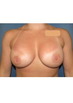 After Image