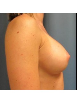 After Image