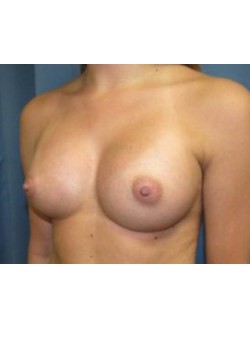 After Image