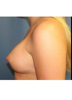 After Image