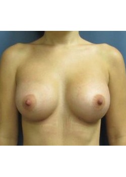 After Image