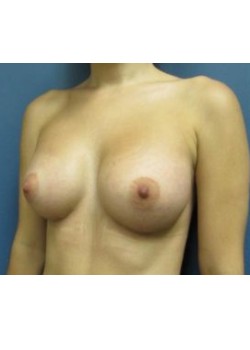 After Image