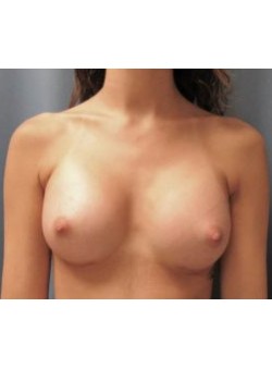 After Image