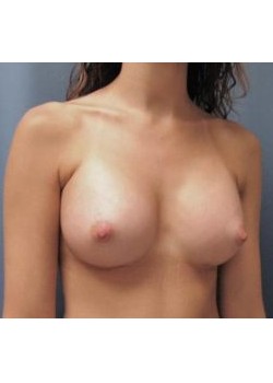After Image