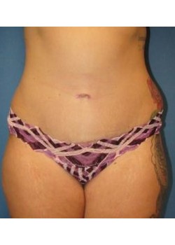 After Image