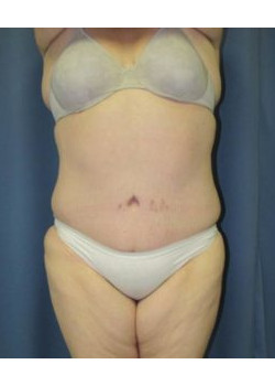 After Image