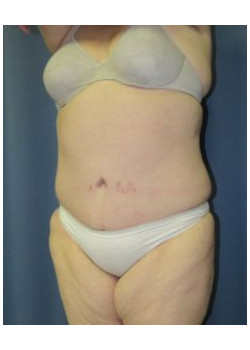 After Image