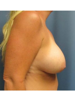 After Image