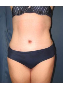 After Image