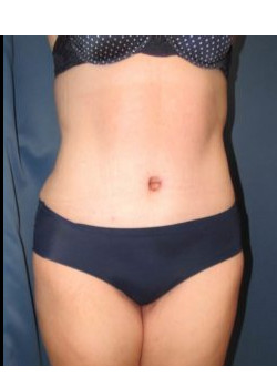 After Image