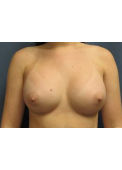 After Image