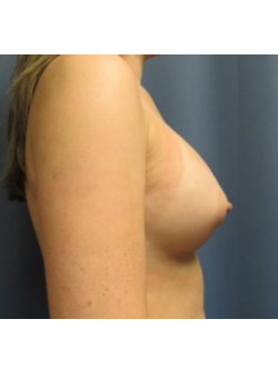 After Image