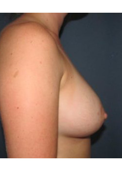 After Image