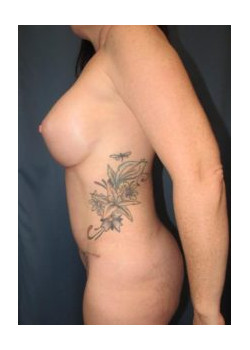 After Image