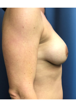 After Image