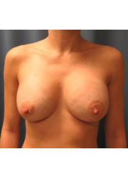 After Image