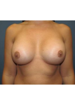 After Image