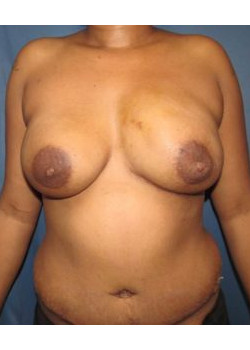 After Image