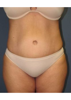 After Image