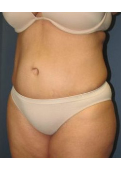 After Image