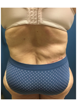 After Image