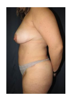After Image