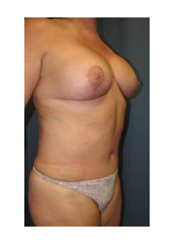 After Image