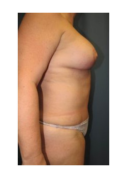After Image