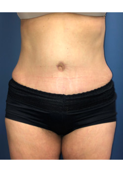 After Image